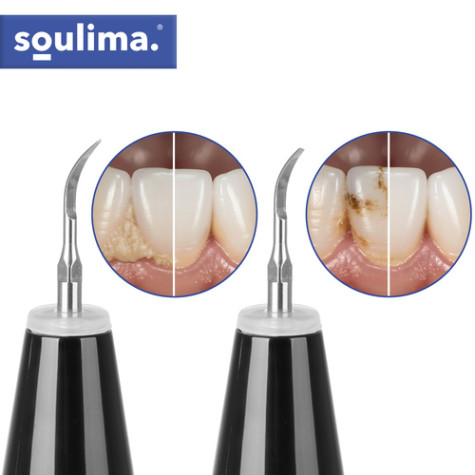 Ultrazvukový odstraňovač zubního kamene Soulima 25746 ~ 6
